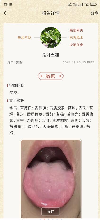 看舌头分析你的健康状态