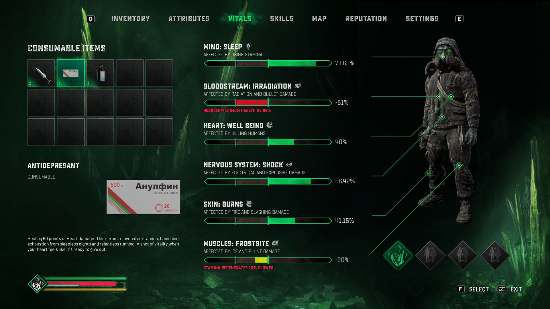 《切尔诺贝利人2：禁区/Chernobylite 2: Exclusion Zone》PC中文版下载-含v77150